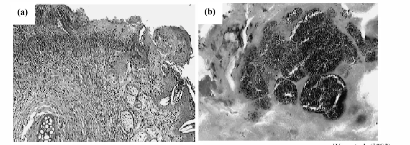 Figure 7 : Images de microscopie optique de l’épiderme de souris atteintes de dermite   (Won et al., 2002) 