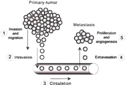 Figure 1.9:  Les 5 étapes de la cascade métastasique. 