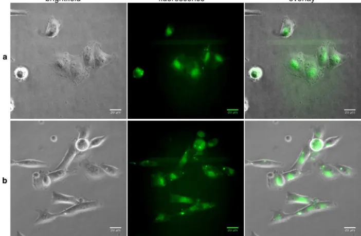 Figure 2. Living MDA-MB-231 cells treated with 500 nM of (a) 1 or (b) 3-pyridyl-BODIPY in culture medium for 30 min at 37°C