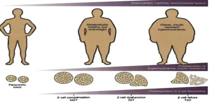 Figure  1 :  Progression  de  la  dégénérescence  des  cellules  Bêta  du  pancréas  en  fonction  de  la  tolérance  à  l' insuline  (prenkti  et al