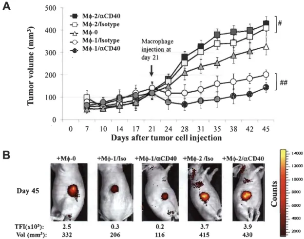 Figure 2  Influence of polarized M(j)s  on the growth of  xenografted endometrial  tumors