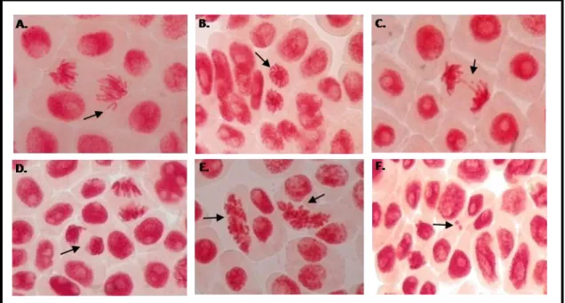 Figure 5. Exemples d’anomalies chromosomiques observées chez Allium cepa. 