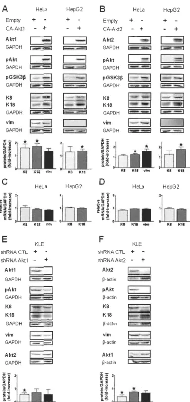 Figure  1.  Intermediate fIlaments are differentially regulated by Aktl and Akt2 isoforms in epithelial  carcinoma cells