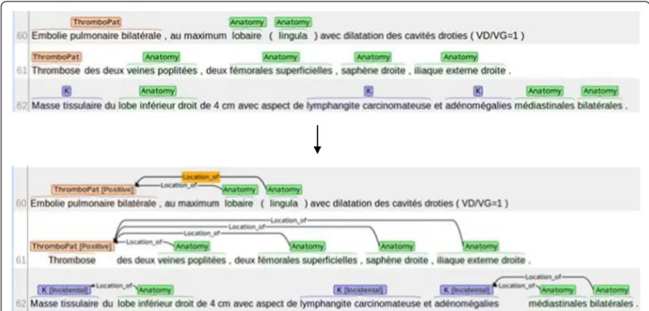 Figure 2 Sample annotated text using Brat. Top: Pre-annotated text using the automatic lexicon matcher