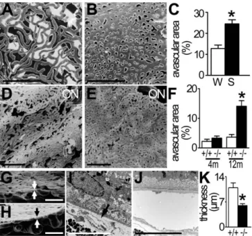 Figure 3. OS-Induced COX2 and VEGF Expression in RPE is CD36 Dependent