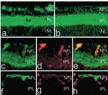 Figure 2. COX expression and PGE 2 levels in retina of models of ischemic proliferative retinopathy