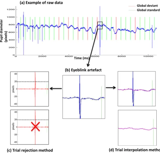 Figure 2.  Raw data and two methods to process eye-blink artefacts (a) Example of raw data (blue curve): 