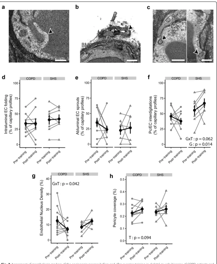 Fig. 2 Assessment of morphologic markers of the angiogenic process before and after exercise training in skeletal muscle biopsies of COPD patients and SHS