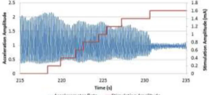 Figure 3: Comparison of different thresholds   for one trajectory of a DBS patient. 