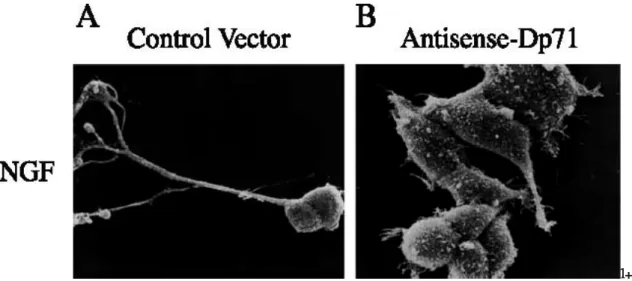 Fig. 4. Scanning electron microscopic analysis of control-vector and antisense-Dp71 clones