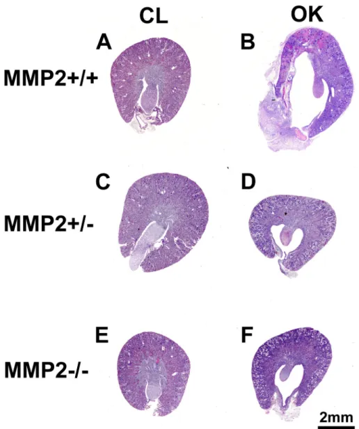 Fig 1. Representative images of Period Acid-Schiff (PAS) stained transversal sections showing increased morphological damage in the Mmp2+/+ obstructed kidney (OK, 1B) compared to the other groups (1 D, F)