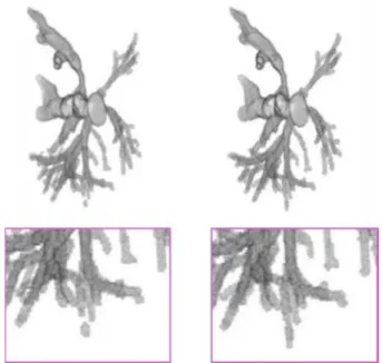 Figure 1: Segmentation by U-Net model (left) vs.  ground  truth (right) from IRCAD dataset, with a zoomed part  (bottom)