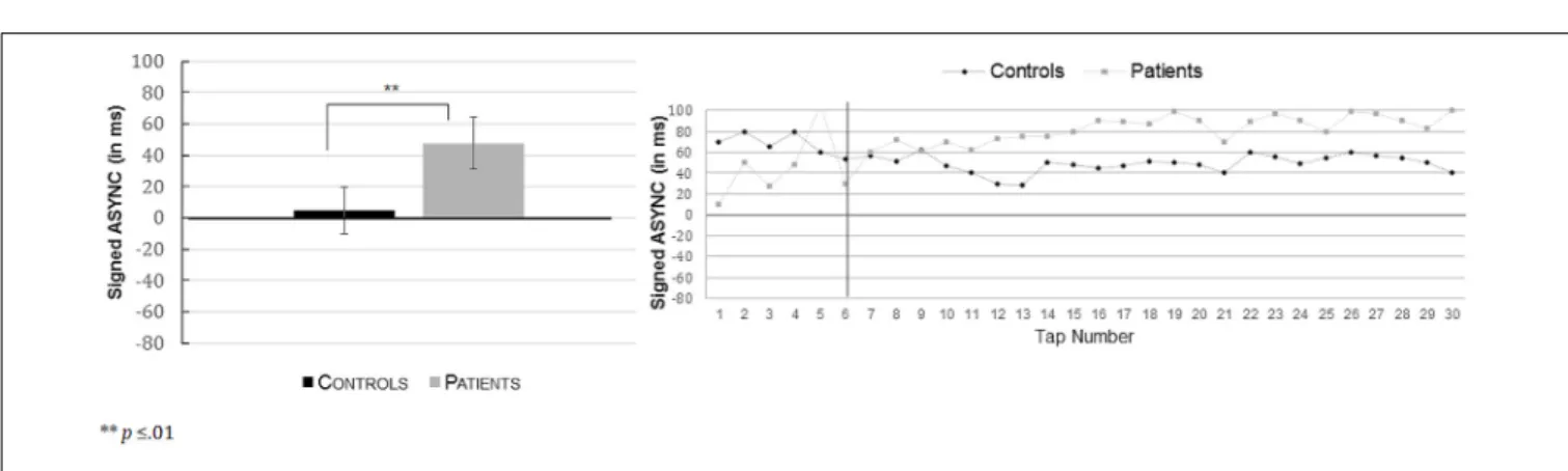 FIGURE 5 | Mean signed asynchronies (ASYNC in ms) (with their respective standard errors) in the alternating non-isochronous rhythmic condition (Left: R-alt) as a function of the group (controls versus patients)