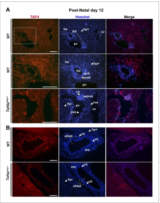 Figure 1. Expression of TAF4 in neonatal liver. (A) The first two panels show immunostaining for TAF4 in sections of  WT liver at P12, while the third panel shows immunostaining in sections from TAF4 mutant liver