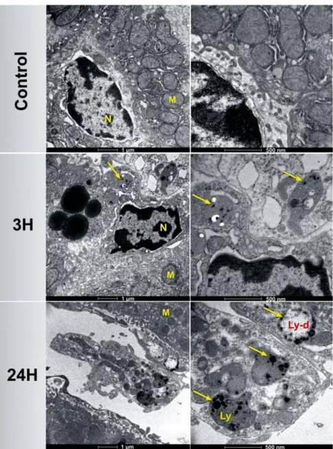 Figure 4.  TEM images of mice livers 3 h and 24 h after the intravenous administration of Si-NPs (20 mg/kg)  compared to the control group administered with NaCl 0.9%