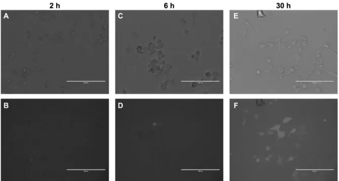 Figure 11. Fluo4-AM release by the pentablock copolymer and Ca 2+  absorption of fibroblast cells at 2 h (A,B),  6 h  (C,D)  and  30 h  (E,F)  post-hydrogel  application;  top  and  bottom  images  are  microscopy  without  and  with  fluorescence, respect