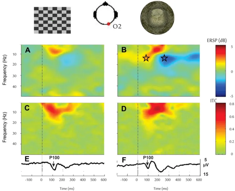 Figure 4. Comparison between checkerboard and 3D tunnel stimuli given at 1 Hz in control participants on Earth