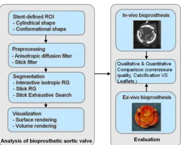 Figure 2: Framework of bioprosthetic aortic valve analysis from MSCT  data. 