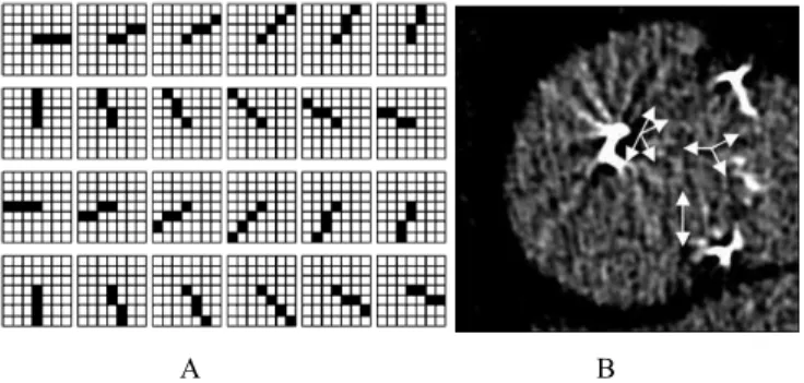 Figure 4  :  A,  4 voxels-length 2D asymmetric sticks  set [18]  and  B, 5  voxel-length  sticks (white arrows) which give the higher output in 4  positions inside leaflets (SNR of this image is 7.54)