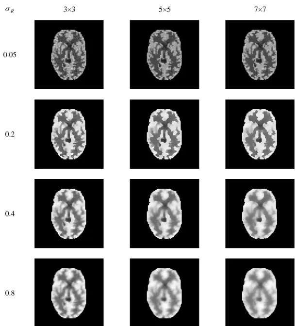 Figure 8: The IIF-MAP Reconstructions with various bilateral filters. ( β = 0 . 25 for all the case) 