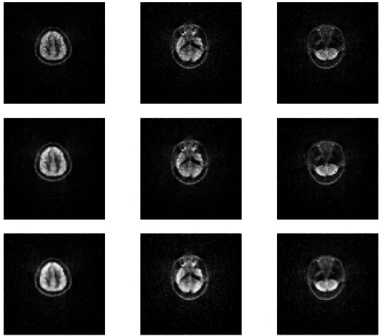 Figure 9: Reconstructions for three different slices using clinical brain PET raw data