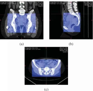 Figure 3: Example of pelvic region cropped according to coxal bone structures on CT images