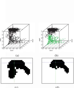 Figure 6: Data fusion and k-means clustering example. (a) voxels belonging to {A, T } lcc placed in the tri-parametric clustering space [SUV HUV T MP ] : SUV value (SUV), Hounsﬁeld unity value (HUV), and the artifact membership probability (AMP)