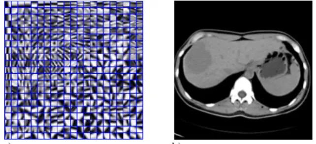 Fig. 2 (a) Dictionary example; (b) Abdomen SDCT image from which the  dictionary has been trained