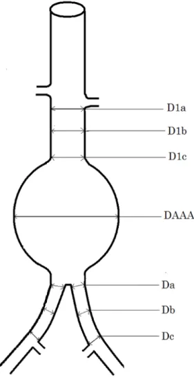 Fig 1. Aortoiliac measurements 