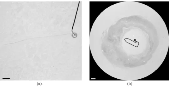 FIG. 7. (a) An agarose disk of radius 2.5 mm is pulled at 6 cm s −1 by an engine. No depleted area is observed, proving that mechanical effects cannot explain what we observe in Fig