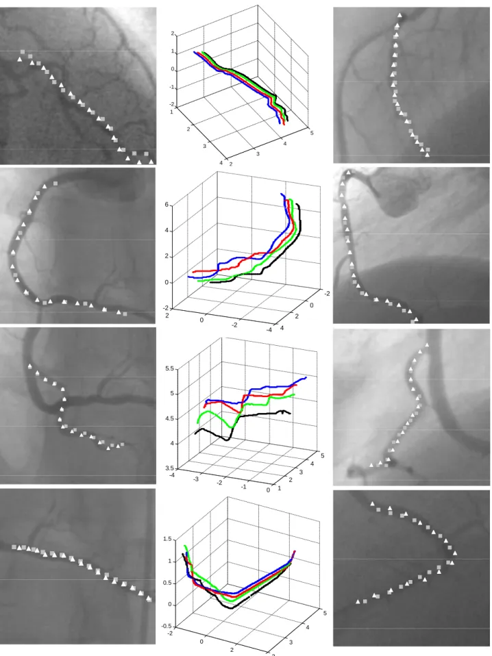 Fig. 5. Comparison of the 2D () vs. 3D () based tracking methods in the planes A (left column) and B (right column)