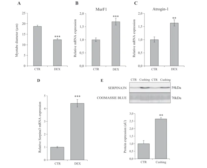 Figure 8 Exposure to glucocorticoids increases human Serpina3 expression in vitro and in vivo
