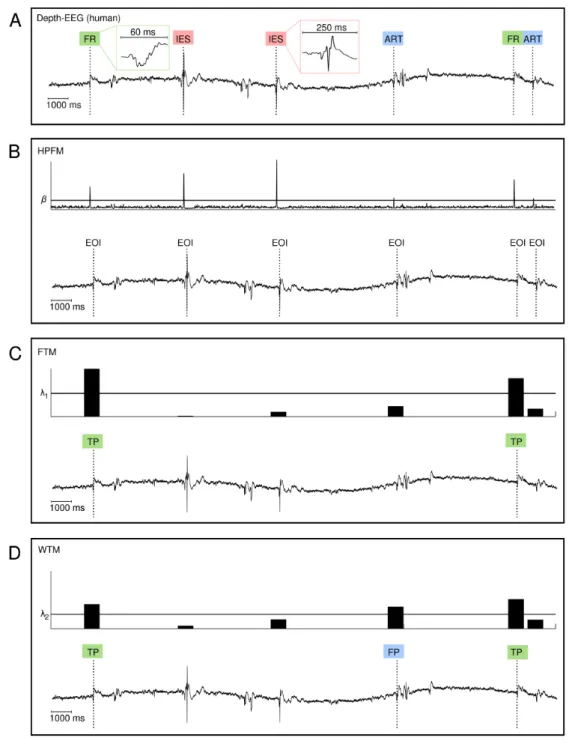 Figure 6: Behavior of proposed methods on real human data (A). The short-time energy in the 256-512 Hz band 