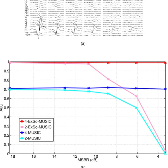 Figure 4: Performance of the source localization approaches with respect to the MSBR. (a) In this study, data were simulated from one single-patch ExSo of 1000 mm 2 placed in the left lateral occipital region