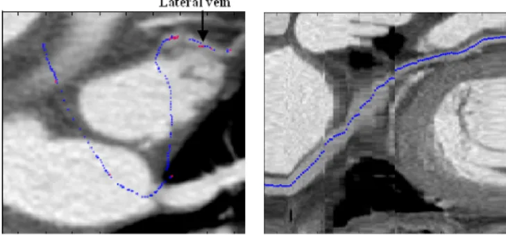 Fig. 6. Tracked path on MIP (Left) and Curvilinear reconstruction (Right) (blue points were extracted with the moment-based process and red ones with the automatic recentring process).
