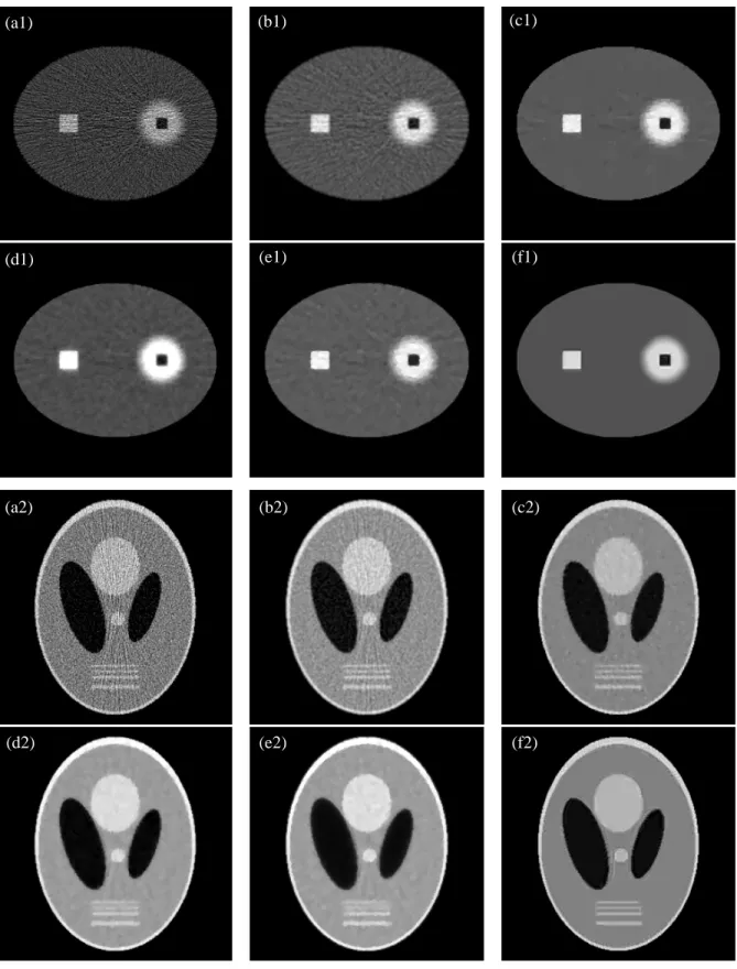 Fig. 4. Low dose reconstructions for the simulated data Phantom1-SL (a1-f1) and Phantom2-SL (a2-f2)