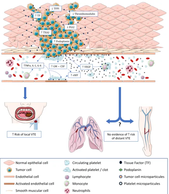 Figure 1. Potential mechanisms involved in thrombosis associated with H&amp;N cancer and their consequences on the local and at-distance VTE risk