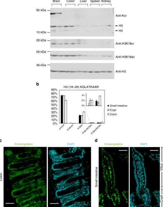 Fig. 1 Histone crotonylation is found in the intestine. a Western blot analysis of whole cell extracts from several mouse tissues using indicated antibodies shows that histone crotonylation is particularly abundant in the brain and colon; the analysis of t