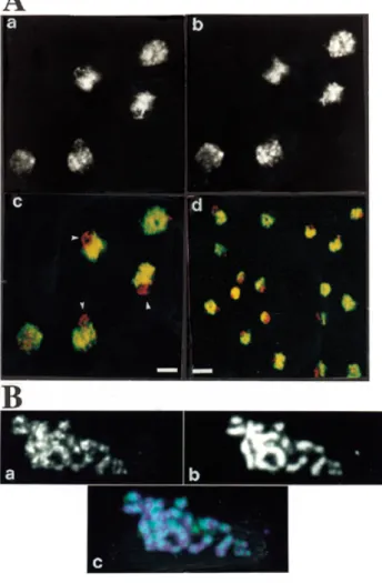 Figure 3. PCR selection of Tbf1p-binding sites. Aliquots of 3 × 10 4 c.p.m. of each probe were incubated without or with 30 µg of proteins of bacterial soluble extract containing the ETBD protein, as indicated