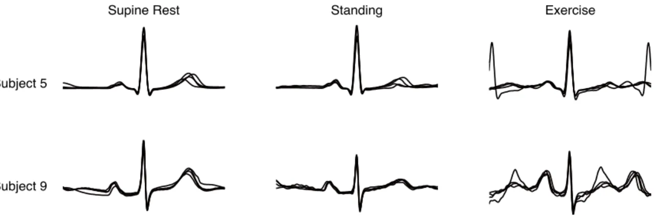 Figure 4: Extracted shapes obtained for subjects 5 and 9 on lead II. For each condition (supine rest, standing and exercise), shapes issued from four different dates are superimposed.