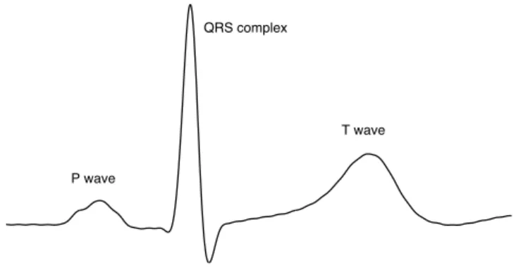 Figure 1: Example of a normal ECG beat (lead II).