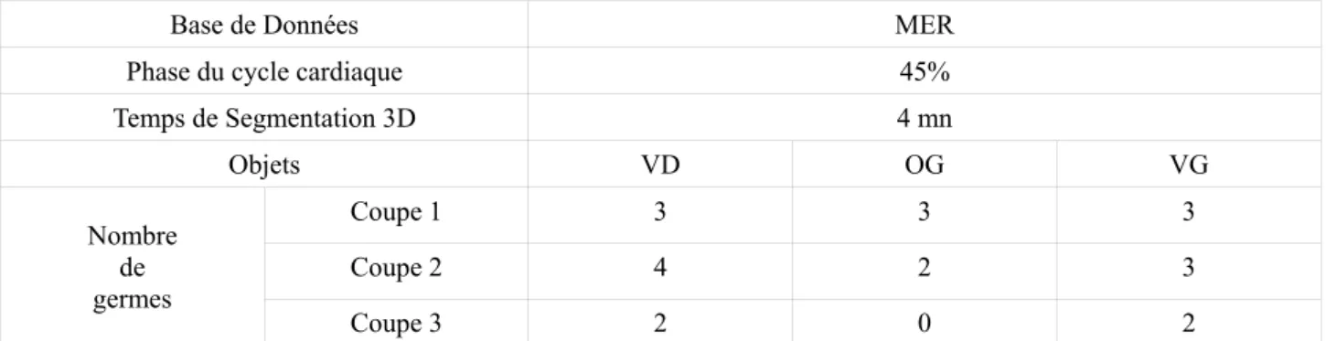 Table I : Configuration de la segmentation 3D (VD, OG, VD). 