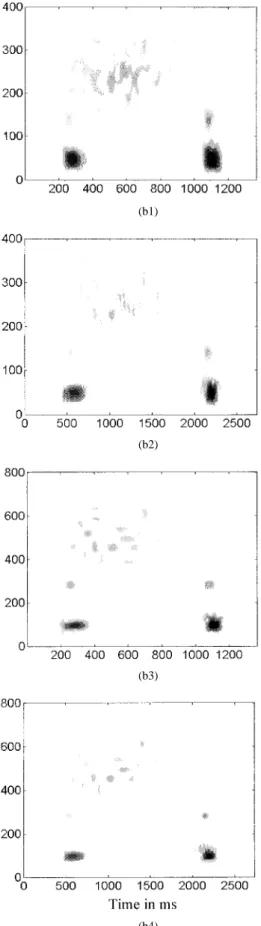 Fig. 6. The MP-based Wigner-distributions (left panels) and spectrograms (right panels) of (a1), (b1) the original signal of the pathological PCG of Fig