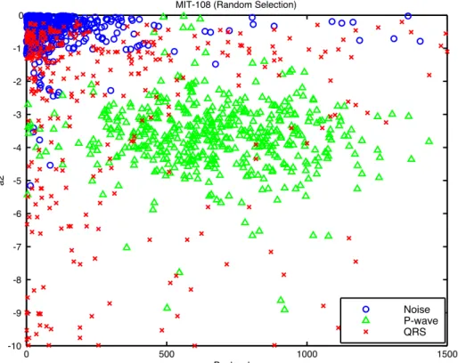 Figure 3. Scatter plot of peak value (a 0 ) and coefficient a 2  for 300 P-wave candidates taken randomly  from register 108 of the MIT-BIH DB, falling into the three defined hypothesis (o- H 0 , x- H 1 , Δ- H 2 ).