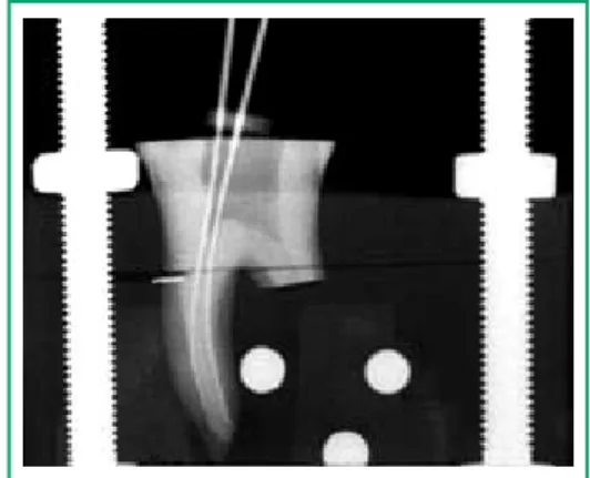Figure 1: X-ray of model.