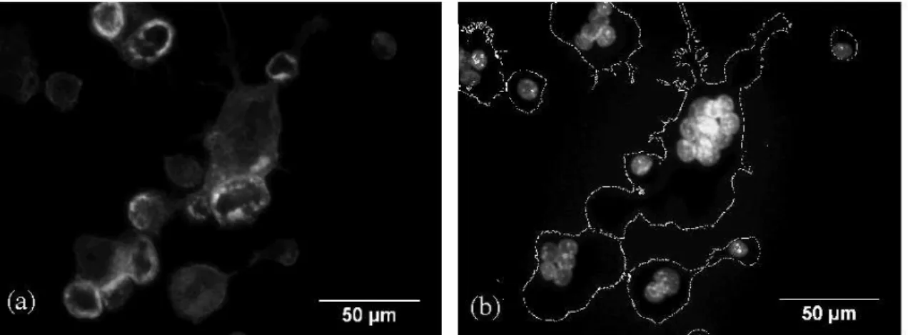 Figure 2.1: Osteoclasts in the fluorescence microscope. (a): Cells are visible thanks to the fluorescence associated with F-actin stained with Phalloidin Alexa 488