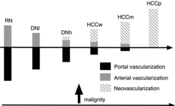 Fig. 1. Evolution of blood supply during hepatocarcinogenesis (RN: