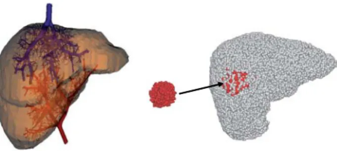 Fig. 2. Model of the macrovascular hepatic network. Left: vascular network (arterial and venous trees); right: macro-functional units (red cells corresponding to tumoral tissue).