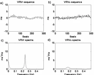 Fig. 5. Decomposition of the VRV for a cardiac transplanted  patient: (a) VRV r  series, (b) VRV u  series, (c) VRV r  power spectra,  and (d) VRV u  power spectra