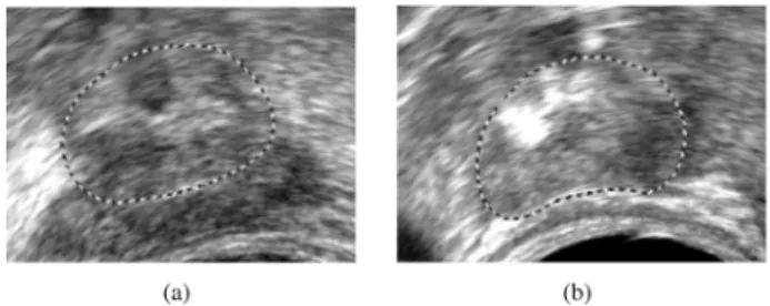 Fig. 3. Initialization: (a) ultrasound image with eight user-selected initial points; (b) initial mesh superimposed on the expert-defined surface.